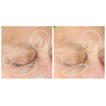 StriVectin Intensive Eye Concentrate for Wrinkles PLUS, 38.35 g + 7.09 g