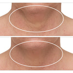 StriVectin TL Advanced Tightening Neck Cream Plus, 2 x 30 mL