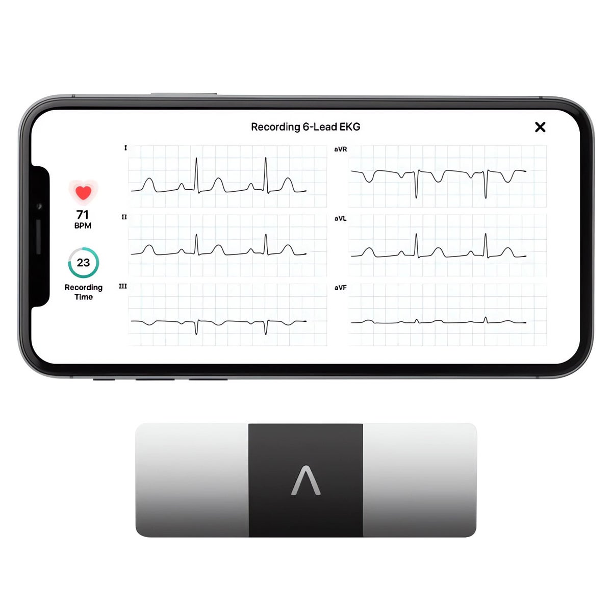 Kardiamobile 6L Personal EKG