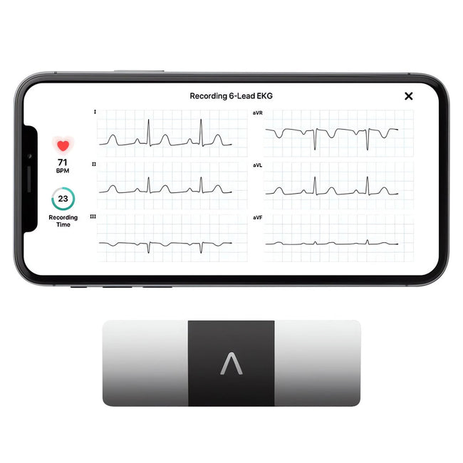 Kardiamobile 6L Personal EKG