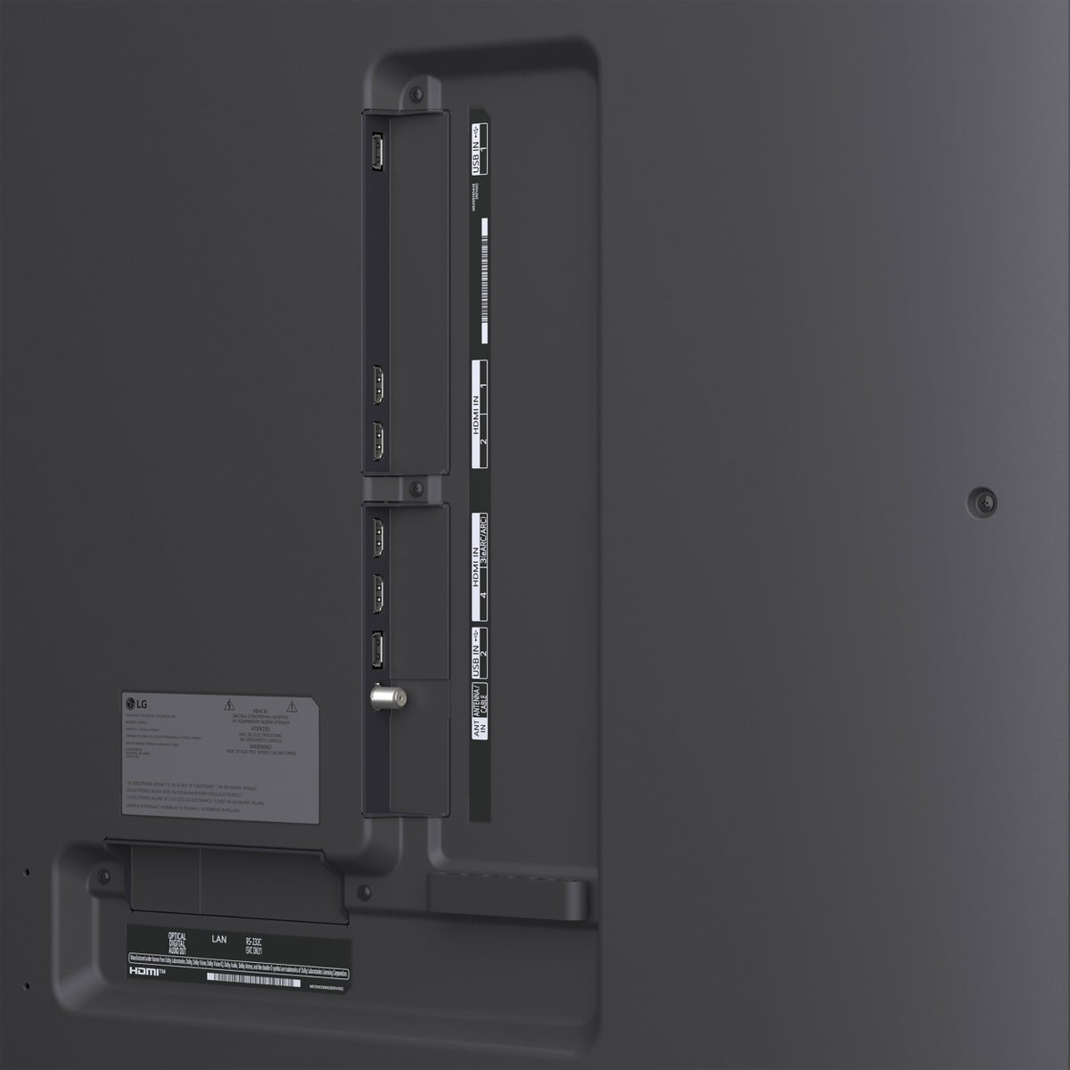 LG 75