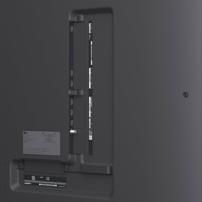 LG 75
