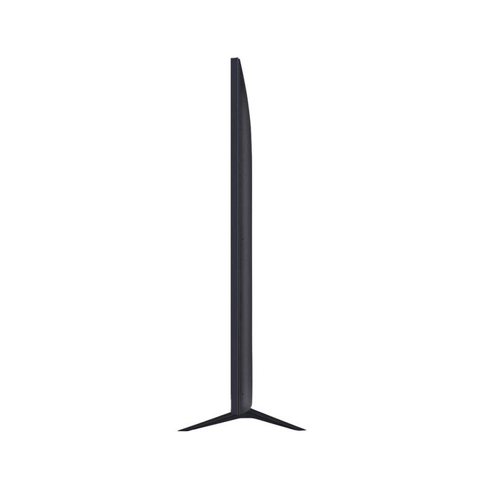LG 75